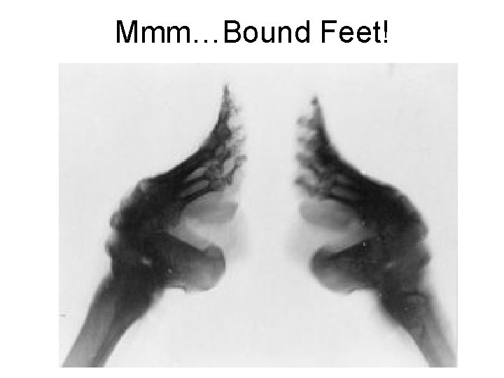 Mmm…Bound Feet! 