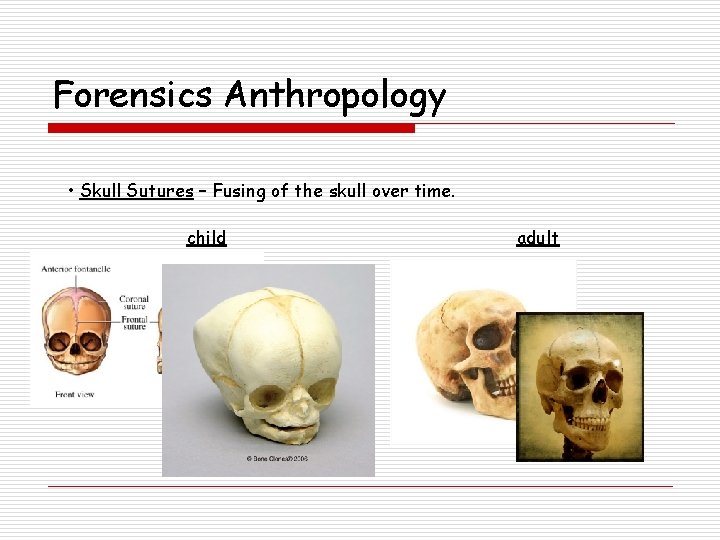 Forensics Anthropology • Skull Sutures – Fusing of the skull over time. child adult