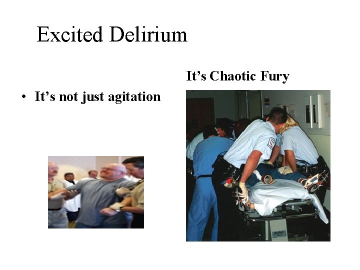 Excited Delirium It’s Chaotic Fury • It’s not just agitation 