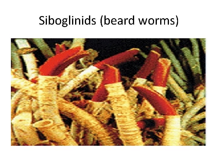 Siboglinids (beard worms) 