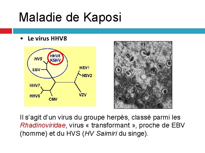Maladie de Kaposi • Le virus HHV 8 Il s’agit d’un virus du groupe Maladie de Kaposi • Le virus HHV 8 Il s’agit d’un virus du groupe