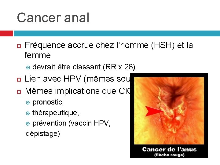 Cancer anal Fréquence accrue chez l’homme (HSH) et la femme devrait être classant (RR Cancer anal Fréquence accrue chez l’homme (HSH) et la femme devrait être classant (RR