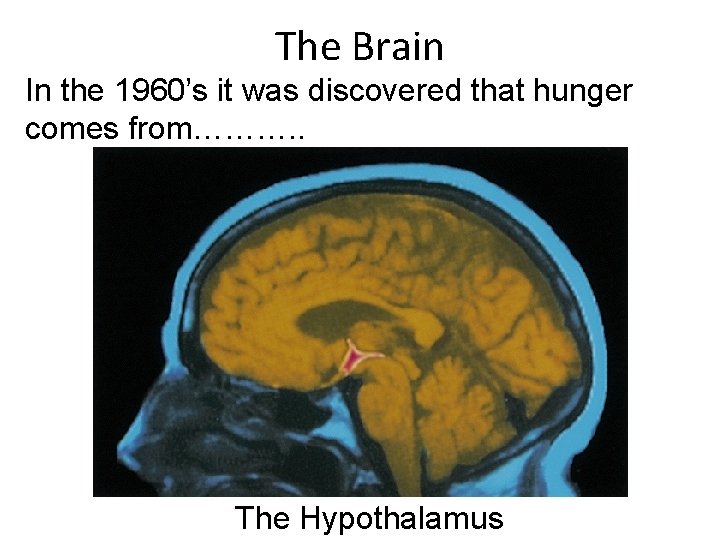 The Brain In the 1960’s it was discovered that hunger comes from………. . The
