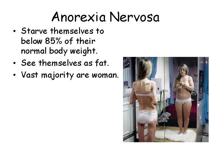 Anorexia Nervosa • Starve themselves to below 85% of their normal body weight. •