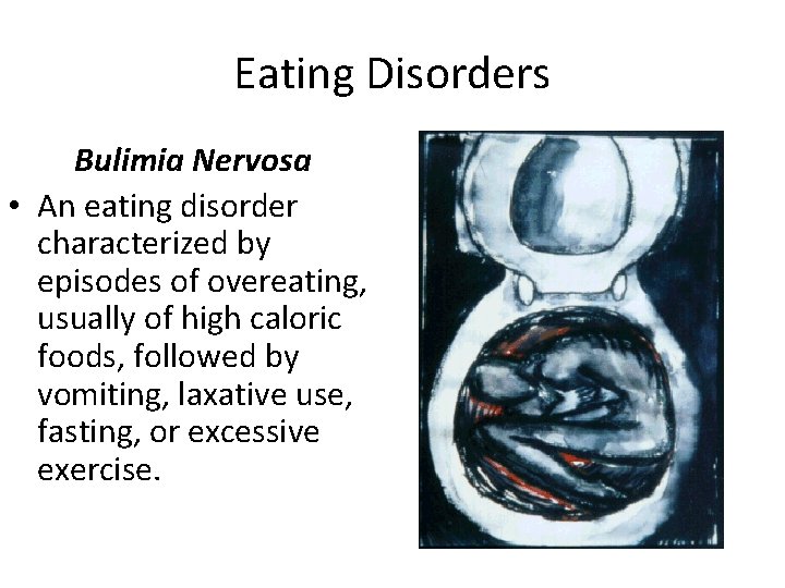 Eating Disorders Bulimia Nervosa • An eating disorder characterized by episodes of overeating, usually