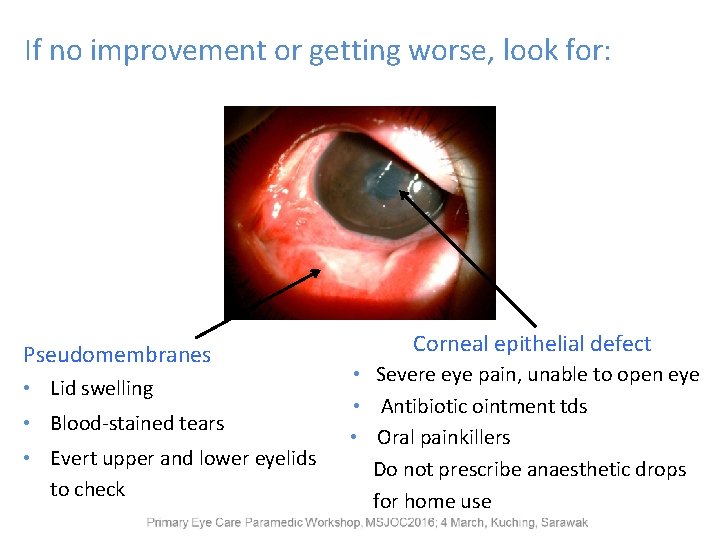 If no improvement or getting worse, look for: Pseudomembranes • Lid swelling • Blood-stained