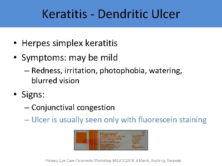 Keratitis - Dendritic Ulcer • Herpes simplex keratitis • Symptoms: may be mild –