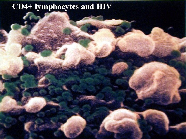 CD 4+ lymphocytes and HIV 