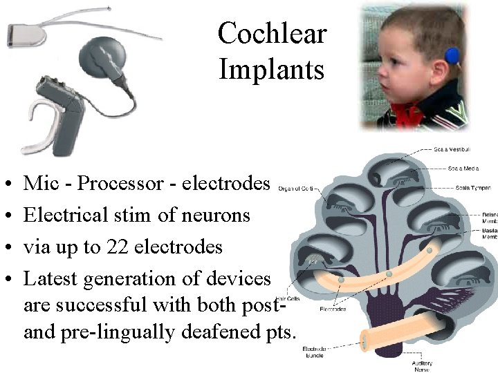 Cochlear Implants • • Mic - Processor - electrodes Electrical stim of neurons via