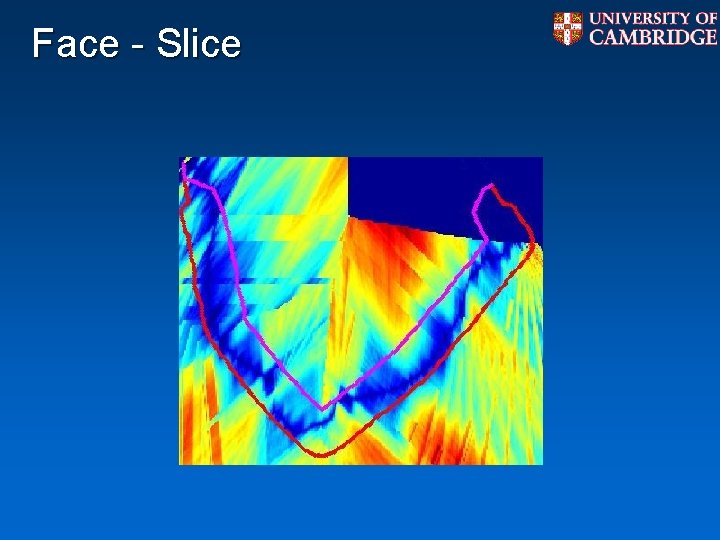 Face - Slice Face - Slice
