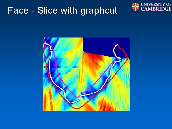 Face - Slice with graphcut Face - Slice with graphcut