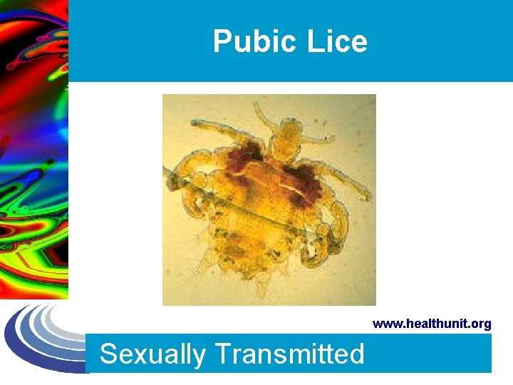 Pubic Lice www. healthunit. org Sexually Transmitted 