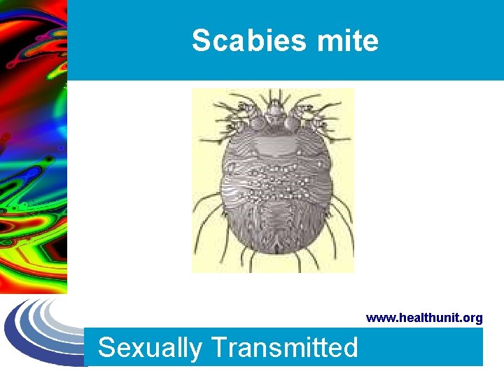 Scabies mite www. healthunit. org Sexually Transmitted 