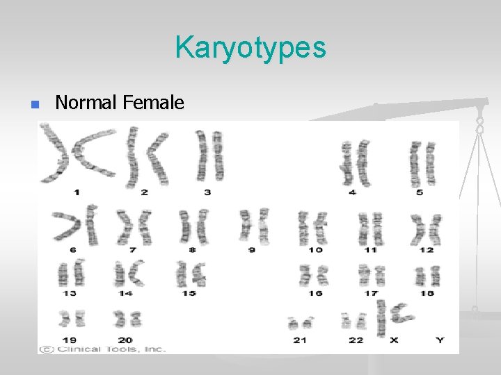 Karyotypes n Normal Female 