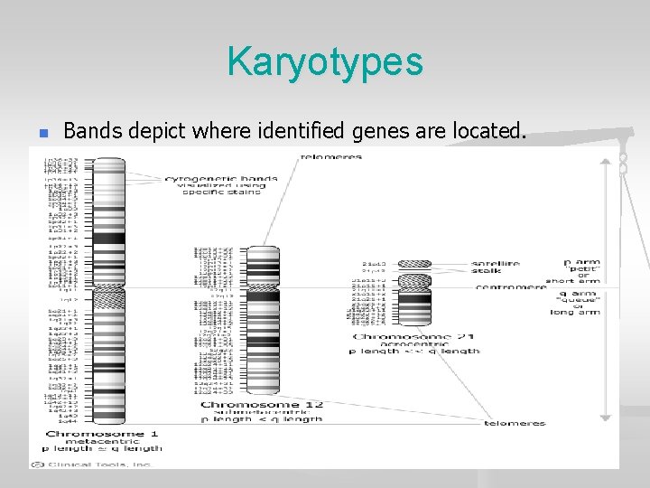 Karyotypes n Bands depict where identified genes are located. 