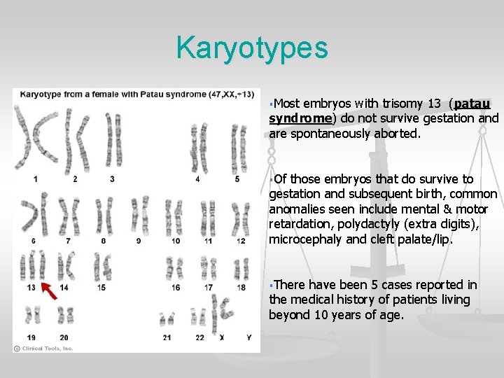 Karyotypes §Most embryos with trisomy 13 (patau syndrome) do not survive gestation and are