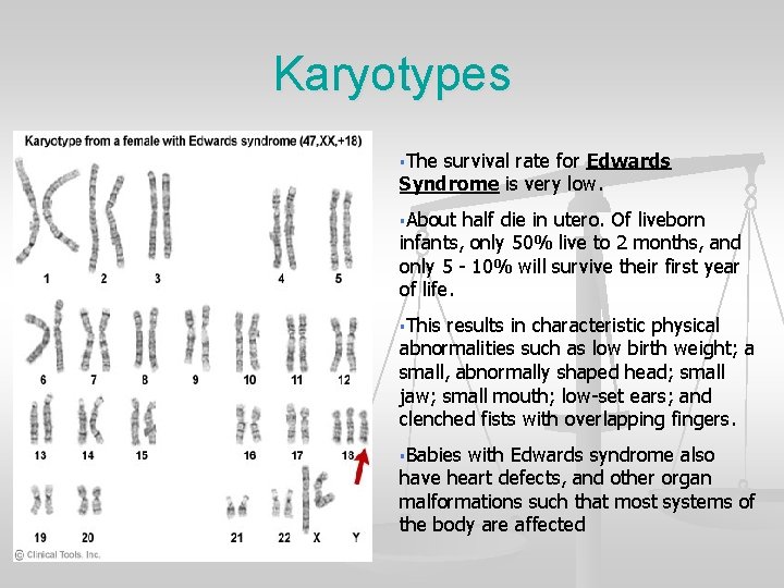 Karyotypes §The survival rate for Edwards Syndrome is very low. §About half die in