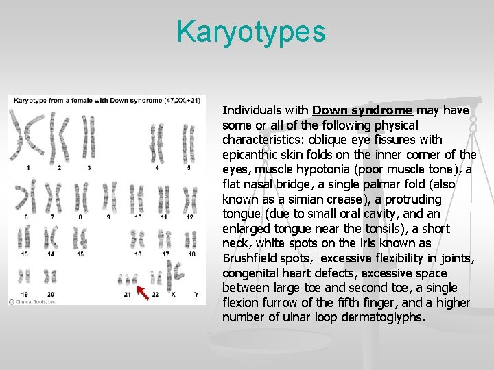 Karyotypes Individuals with Down syndrome may have some or all of the following physical