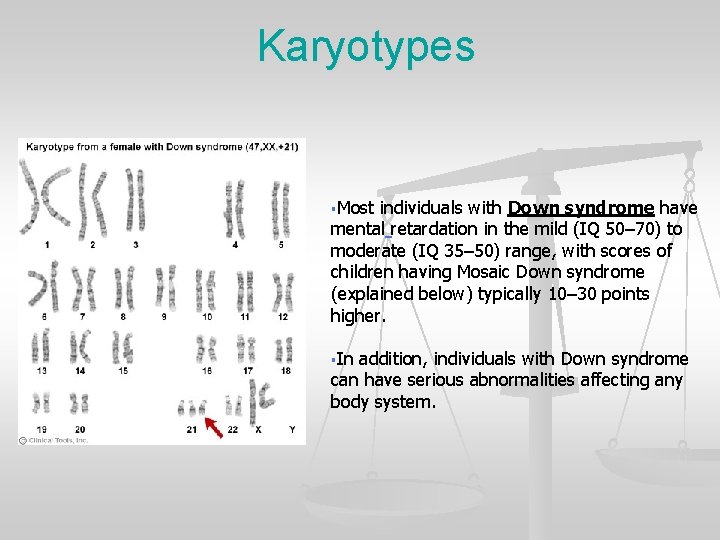 Karyotypes §Most individuals with Down syndrome have mental retardation in the mild (IQ 50–