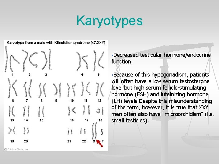 Karyotypes §Decreased function. §Because testicular hormone/endocrine of this hypogonadism, patients will often have a