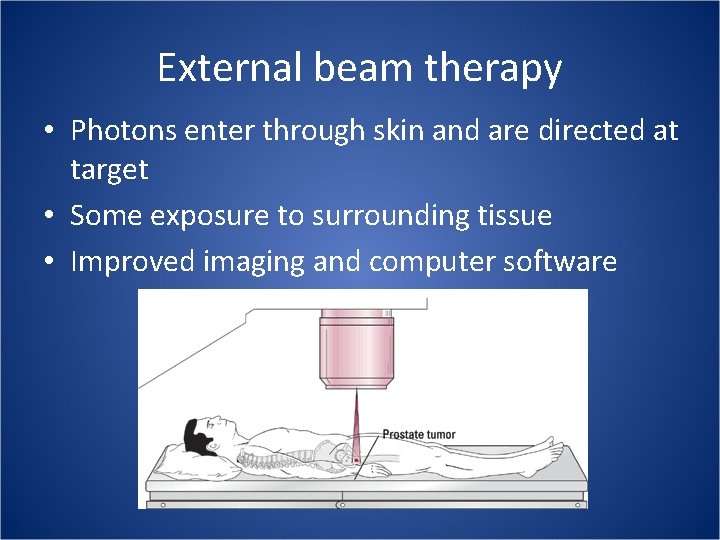 External beam therapy • Photons enter through skin and are directed at target •