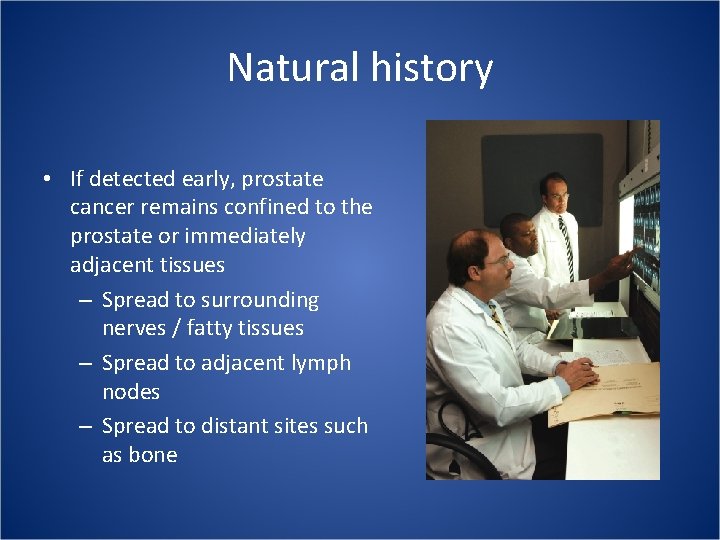 Natural history • If detected early, prostate cancer remains confined to the prostate or