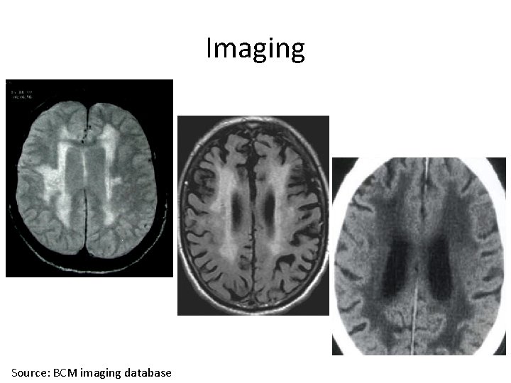 Imaging Source: BCM imaging database 