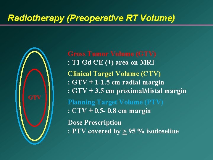 Radiotherapy (Preoperative RT Volume) Gross Tumor Volume (GTV) : T 1 Gd CE (+)