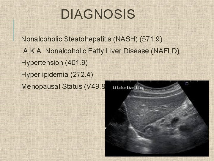 DIAGNOSIS Nonalcoholic Steatohepatitis (NASH) (571. 9) A. K. A. Nonalcoholic Fatty Liver Disease (NAFLD)