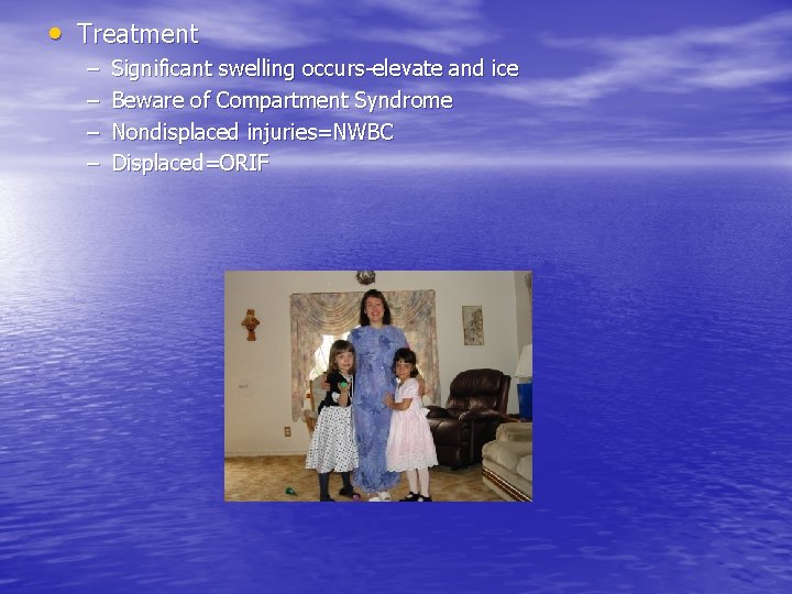  • Treatment – – Significant swelling occurs-elevate and ice Beware of Compartment Syndrome