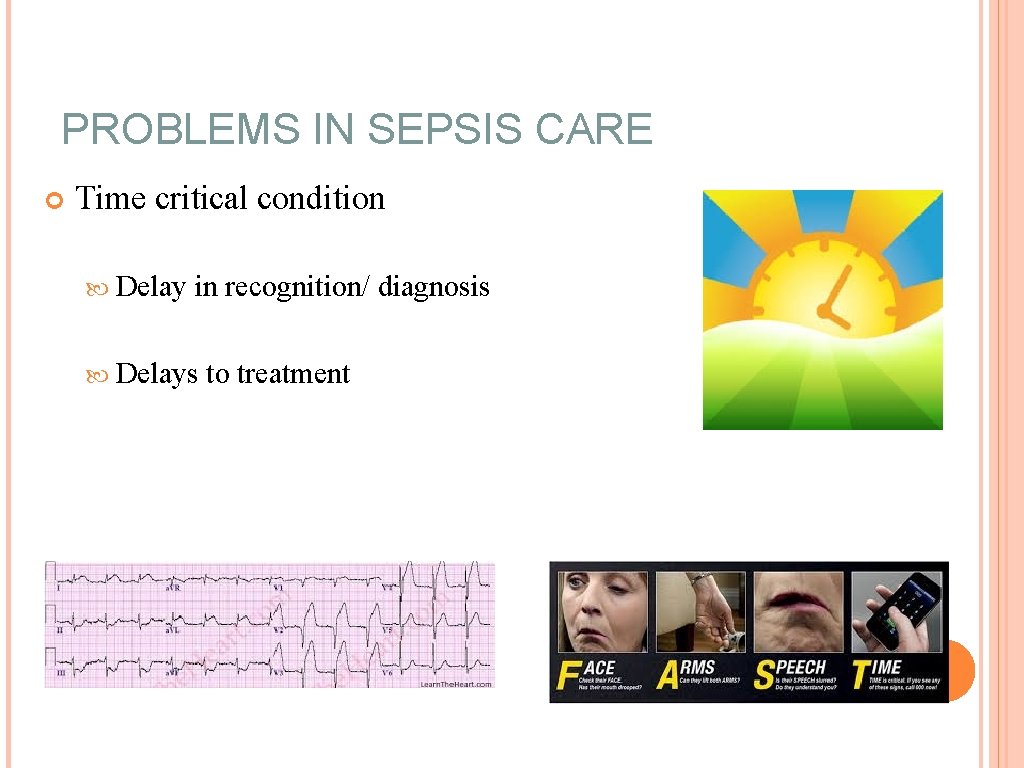 PROBLEMS IN SEPSIS CARE Time critical condition Delay in recognition/ diagnosis Delays to treatment