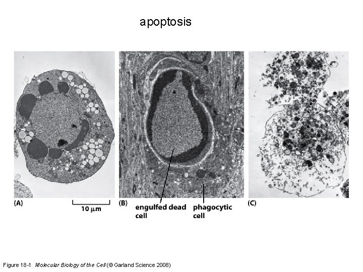 apoptosis Figure 18 -1 Molecular Biology of the Cell (© Garland Science 2008) 