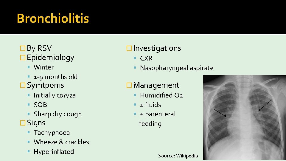 Bronchiolitis � By RSV � Epidemiology Winter 1 -9 months old � Symtpoms Initially