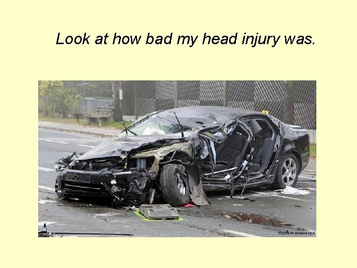 Look at how bad my head injury was. Look at how bad my head injury was.