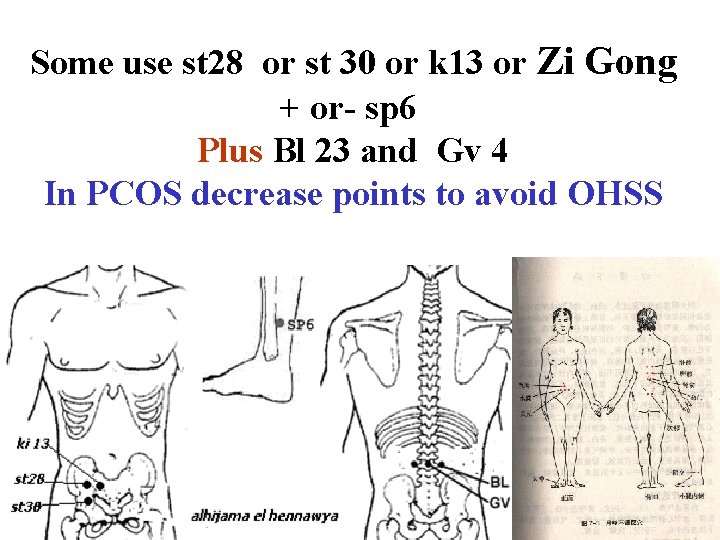  Some use st 28 or st 30 or k 13 or Zi Gong