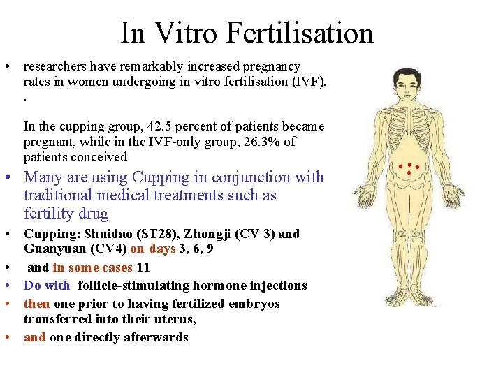 In Vitro Fertilisation • researchers have remarkably increased pregnancy rates in women undergoing in