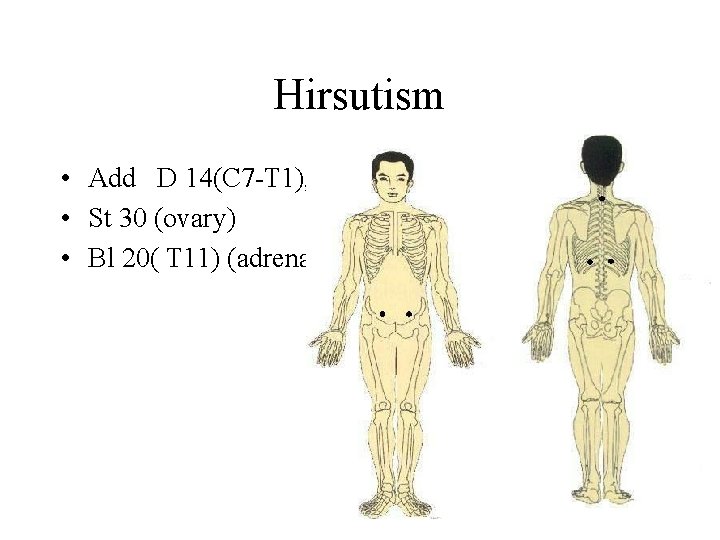 Hirsutism • Add D 14(C 7 -T 1), • St 30 (ovary) • Bl