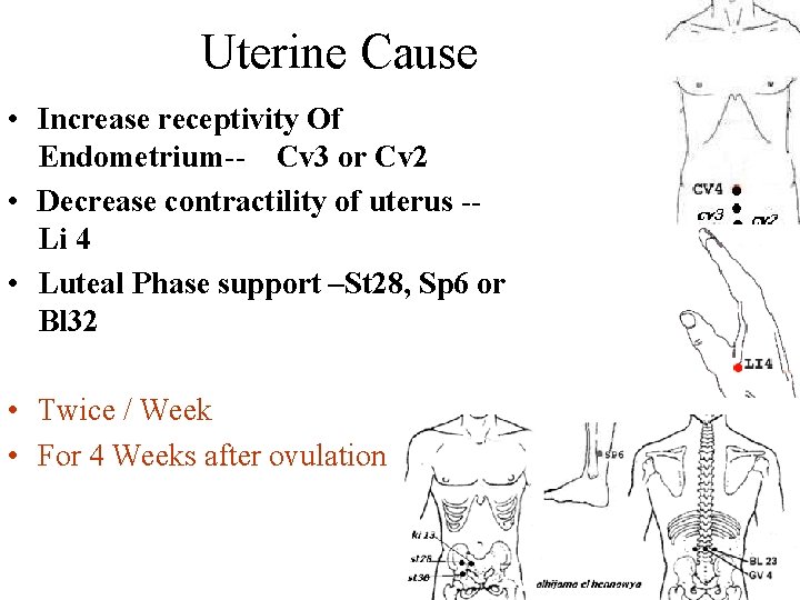 Uterine Cause • Increase receptivity Of Endometrium-- Cv 3 or Cv 2 • Decrease