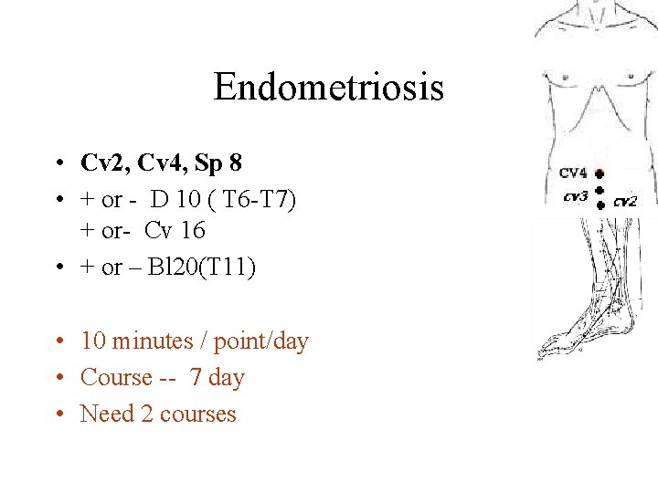 Endometriosis • Cv 2, Cv 4, Sp 8 • + or - D 10