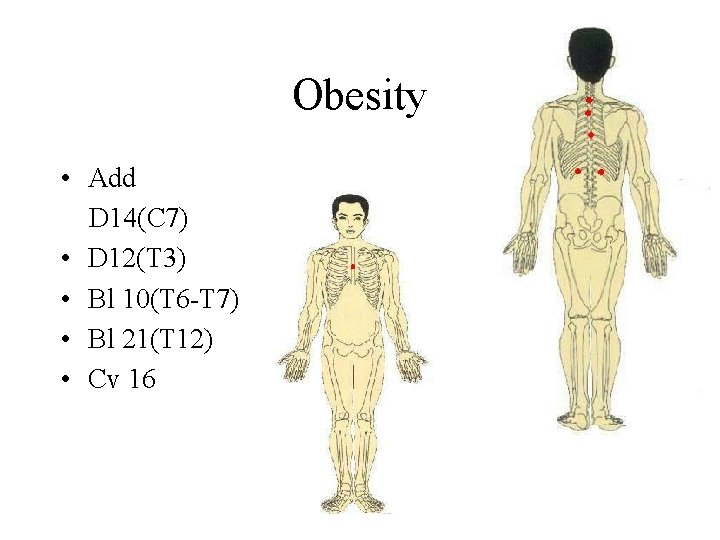 Obesity • Add D 14(C 7) • D 12(T 3) • Bl 10(T 6