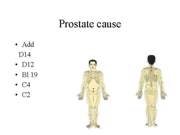 Prostate cause • Add D 14 • D 12 • Bl 19 • C