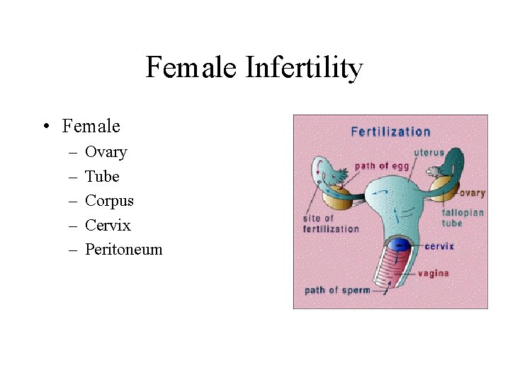 Female Infertility • Female – – – Ovary Tube Corpus Cervix Peritoneum 