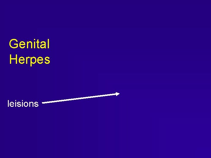 Genital Herpes leisions Genital Herpes leisions