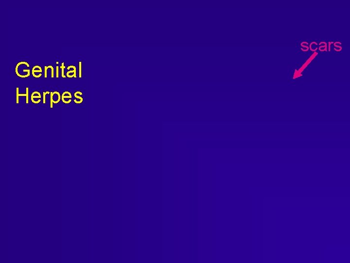 scars Genital Herpes scars Genital Herpes
