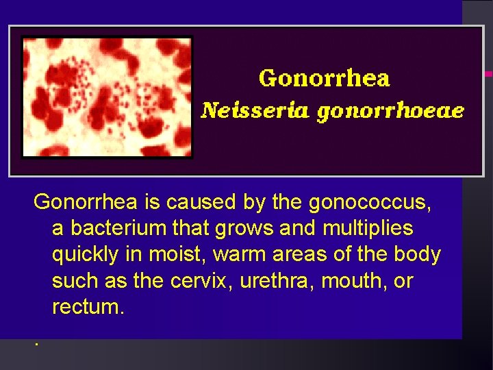 Gonorrhea is caused by the gonococcus, a bacterium that grows and multiplies quickly in Gonorrhea is caused by the gonococcus, a bacterium that grows and multiplies quickly in