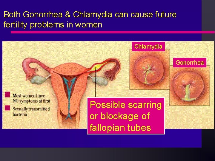 Both Gonorrhea & Chlamydia can cause future fertility problems in women Chlamydia Gonorrhea Possible Both Gonorrhea & Chlamydia can cause future fertility problems in women Chlamydia Gonorrhea Possible