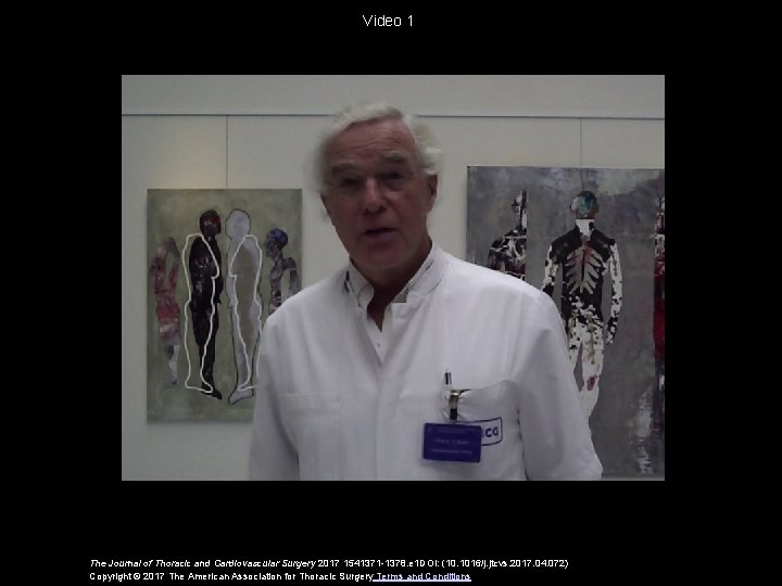 Video 1 The Journal of Thoracic and Cardiovascular Surgery 2017 1541371 -1378. e 1