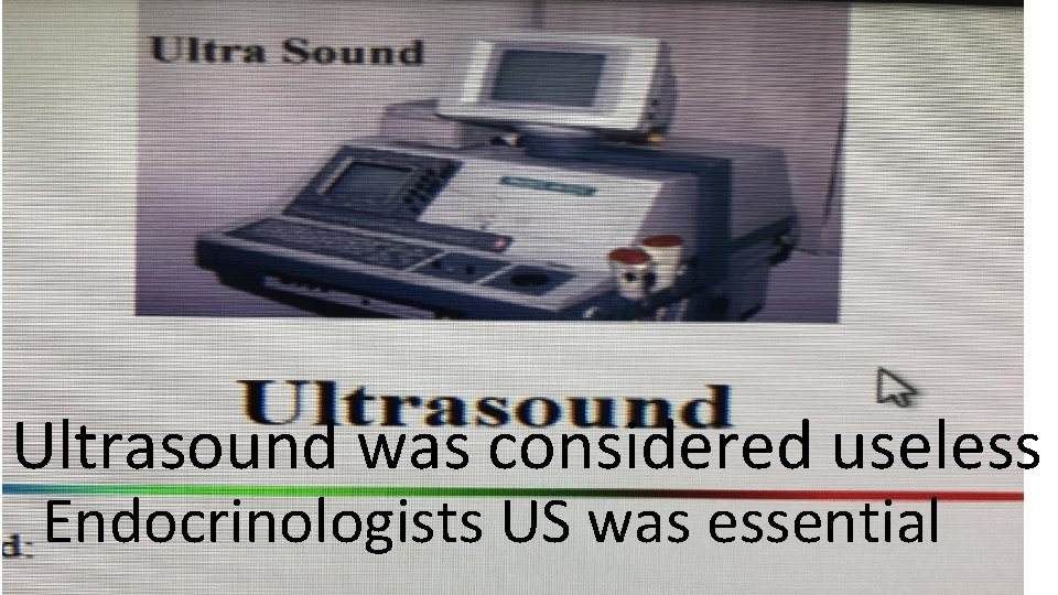 Ultrasound was considered useless Endocrinologists US was essential 