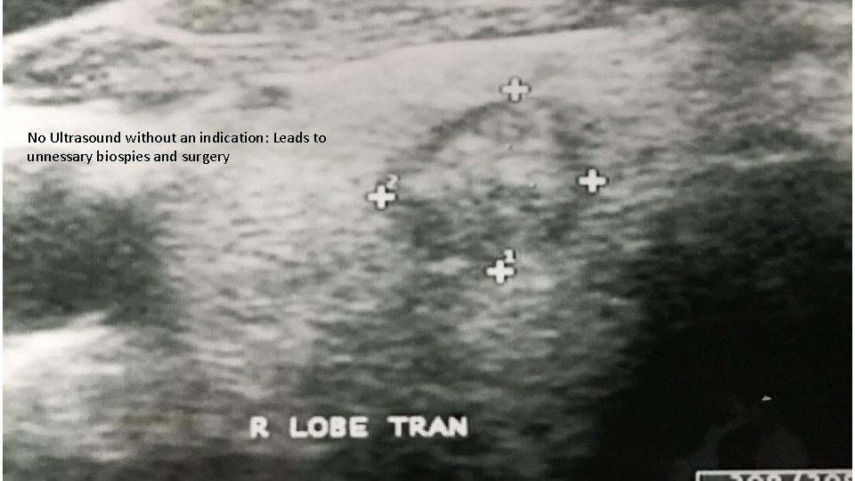 No Ultrasound without an indication: Leads to unnessary biospies and surgery 