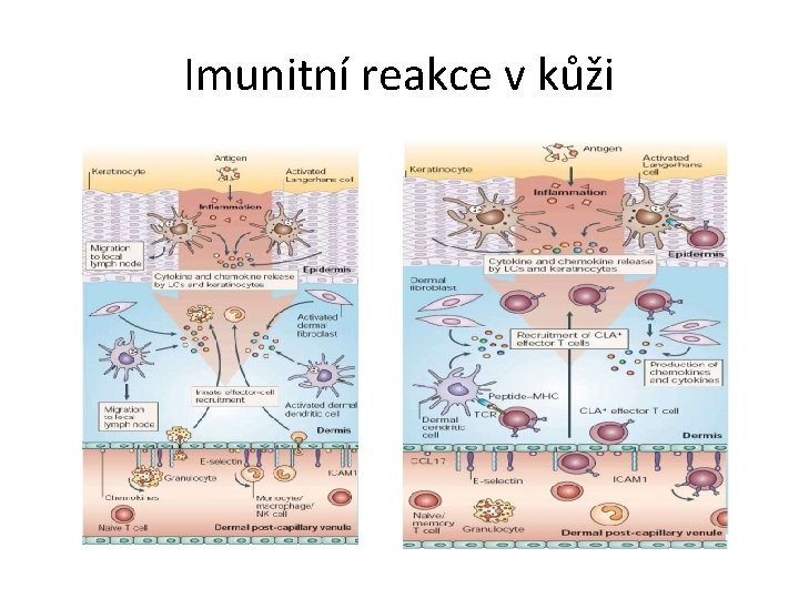 Imunitní reakce v kůži 